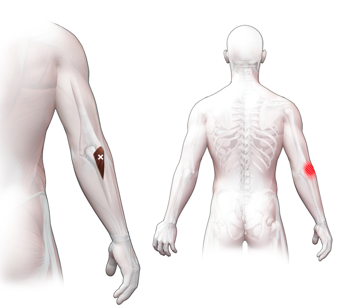 Anconeus-Sp-T